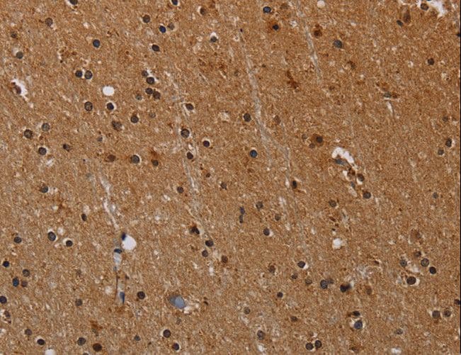 Polyclonal Rabbit anti-Human PARP8 Antibody (IHC)