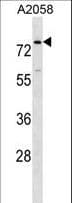 Polyclonal Rabbit anti-Human BCAS1 / NABC1 Antibody (aa1-30, WB)