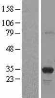 PSME3 Protein (Over-Expression Lysate Myc-DDK (Flag))