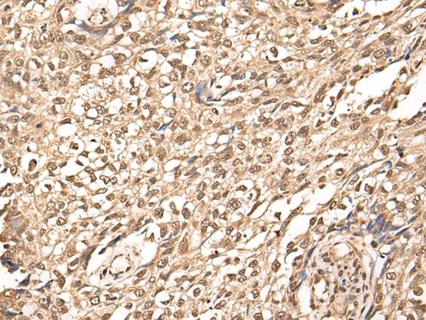 ATAD3A Antibody