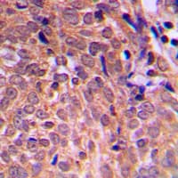 Polyclonal Rabbit anti-Human APC Antibody (C-Terminus, IHC, IF, WB)