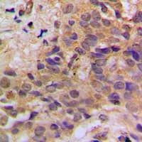 TP53 / p53 Antibody (phospho-Ser37)