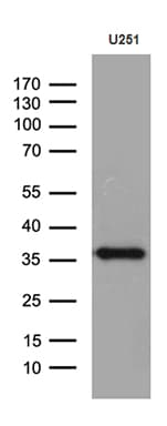 Monoclonal Mouse anti-Human DTWD1 Antibody (clone OTI2C2, WB)