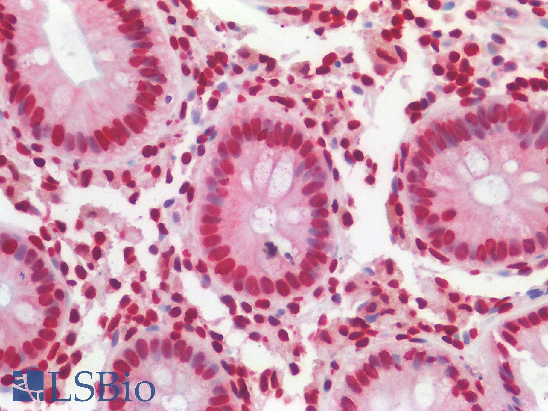 IHC-plus™ Polyclonal Rabbit anti-Human SREBF2 / SREBP2 Antibody (aa455-469, IHC, WB)