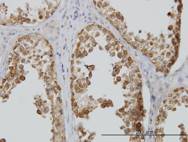 DDX6 Antibody (clone 3D2)