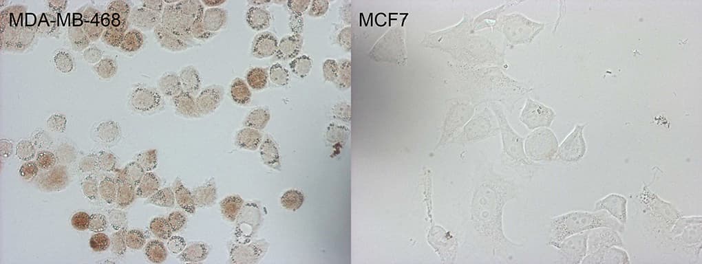 p16INK4a / CDKN2A Antibody (clone OTI13E10)