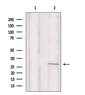 C/EBP Delta / CEBPD Antibody