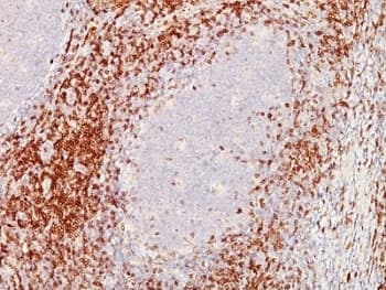 CD5 Antibody (clone C5/473 + CD5/54/F6)