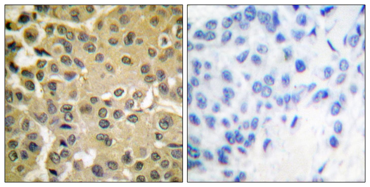 Polyclonal Rabbit anti-Human SMAD3 Antibody (phospho-Ser425, IHC, WB)