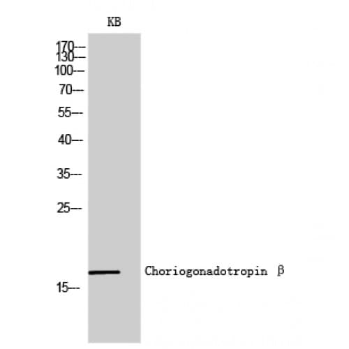 CGB / hCG Beta Antibody (70-150 aa, C-terminal)