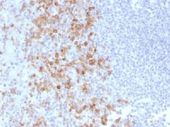 SELPLG / PSGL-1 / CD162 Antibody (clone PSGL1/1601)