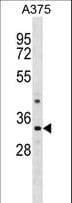 PRR7 Antibody (aa171-199)