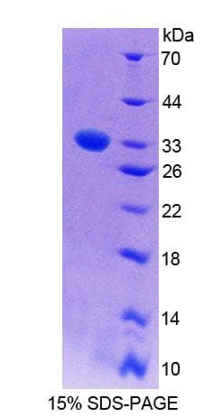 Mouse PCYOX1 Protein (Recombinant His-T7)