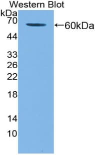 KIR2DL3 / CD152B2 Antibody (aa22-341)