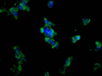 ADAM23 Antibody