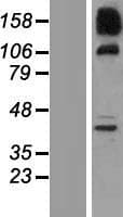 SNX19 Protein (Over-Expression Lysate Myc-DDK (Flag))