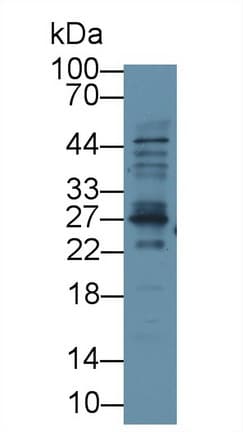 TREM1 Antibody (aa21-205)