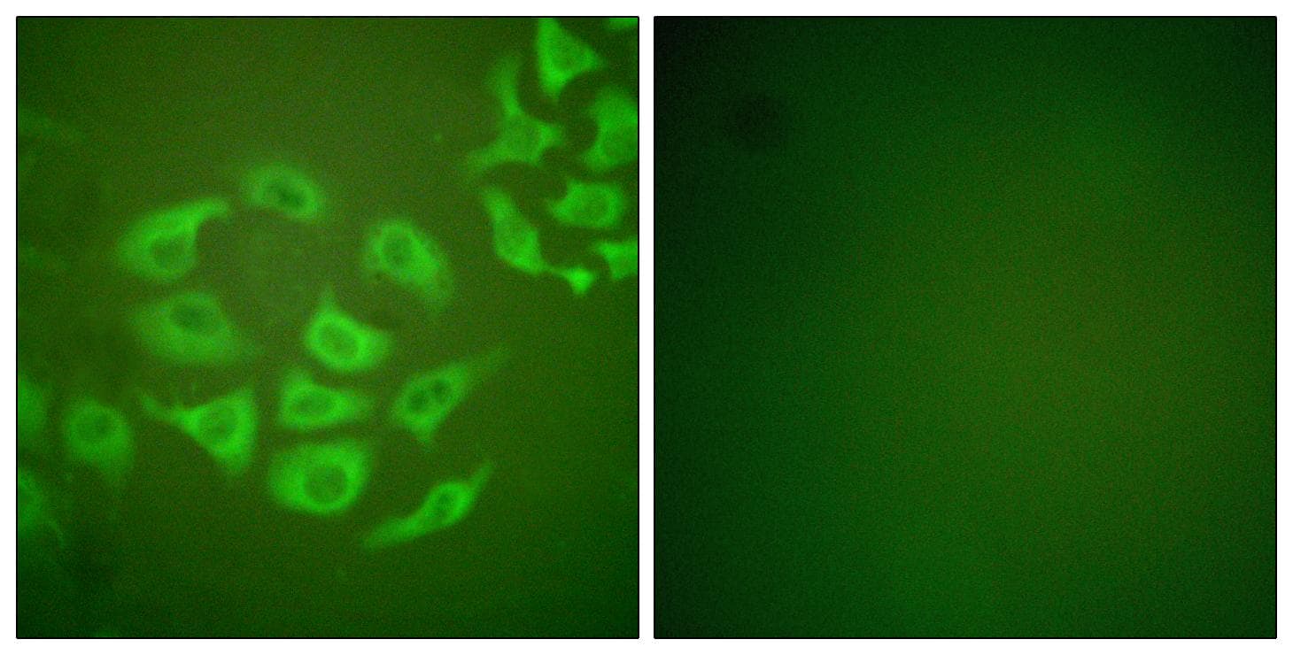 MMP10 Antibody