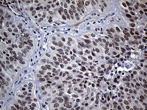 SDCCAG1 / NEMF Antibody (aa869-1076, clone OTI7E10)