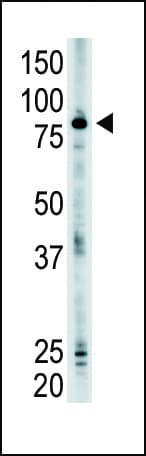 SMURF2 Antibody (aa6-36)