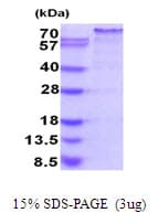 Human GRAB / RAB3IL1 Protein (Recombinant His)