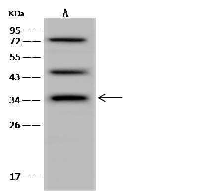 CALHM2 Antibody
