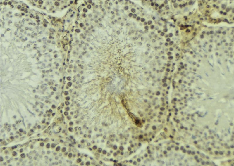 Polyclonal Rabbit anti-Human UHRF1 Antibody (IHC, IF, WB)