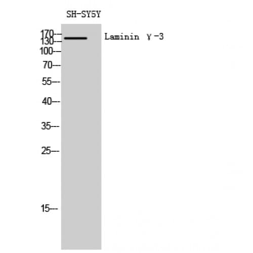 LAMC3 / Laminin Gamma 3 Antibody (1330-1410 aa, C-terminal)