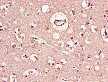 Polyclonal Rabbit anti-Human C1QTNF9B Antibody (IHC, IF)