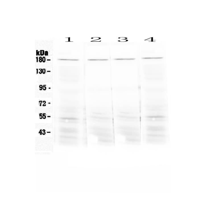 ACE / CD143 Antibody