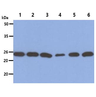PSMD10 / Gankyrin Antibody (clone AT1F4)