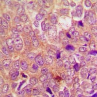 Polyclonal Rabbit anti-Human UBR1 Antibody (Internal, IHC, WB)