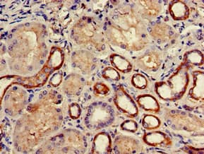 ADCK4 Antibody