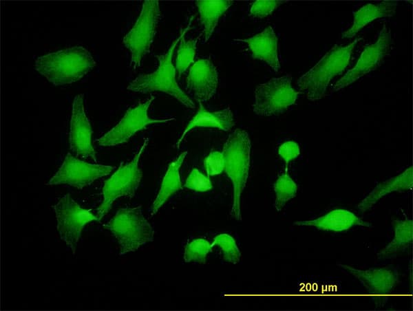 Monoclonal Mouse anti-Human PBK / TOPK Antibody (clone 3A7, IHC, IF, WB)