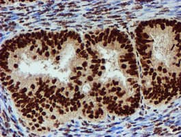 Monoclonal Mouse anti-Human PADI4 / PAD4 Antibody (clone OTI4H5, IHC, IF, WB)