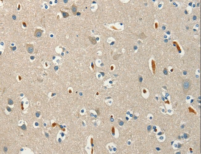 SERPINA9 Antibody
