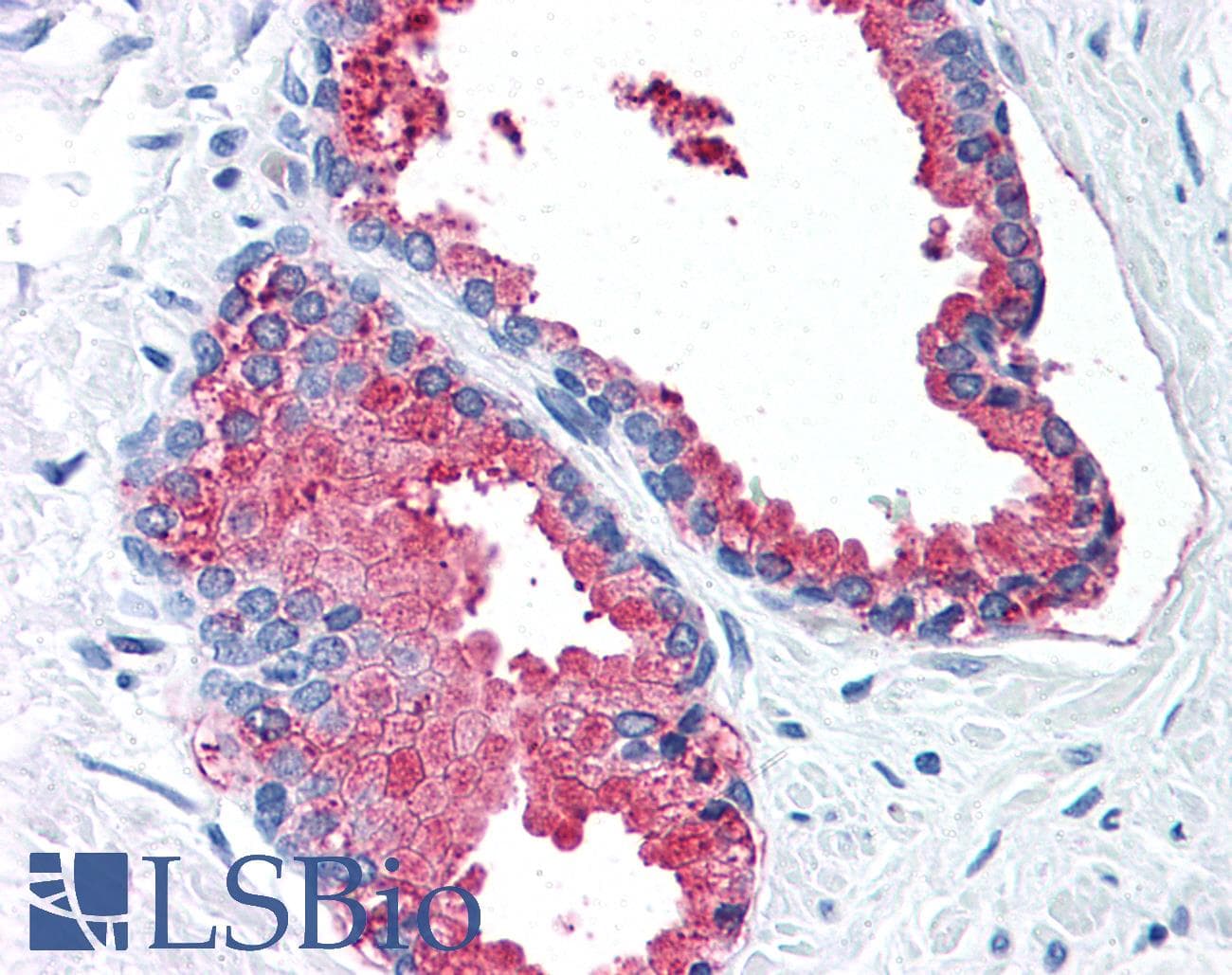 IHC-plus™ LOXL2 Antibody (Internal)