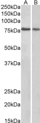 IHC-plus™ TRIM3 Antibody (aa2-14)