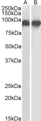IHC-plus™ ITGB2 / CD18 Antibody (aa86-99)