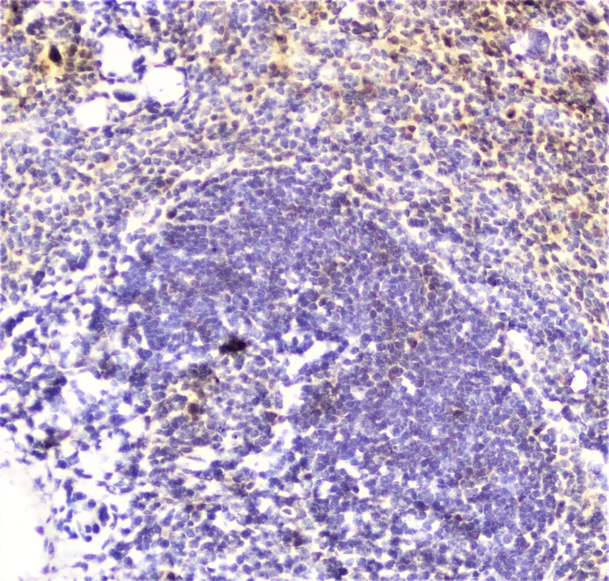 DDT / Dopamine Tautomerase Antibody
