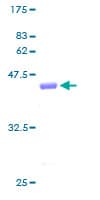 Human CLP / COTL1 Protein (Recombinant GST)
