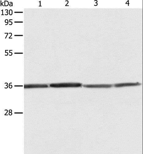 Polyclonal Rabbit anti-Human RPLP0 Antibody (IHC, WB)