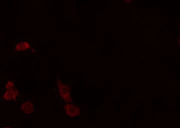 EPOR / EPO Receptor Antibody
