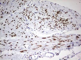 Monoclonal Mouse anti-Human PR / Progesterone Receptor Antibody (clone OTI2E2, aa1-298, IHC, WB)