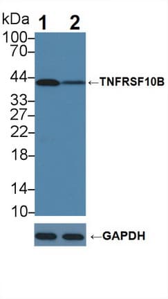 Polyclonal Rabbit anti-Human TNFRSF10B / Killer / DR5 Antibody (aa234-435, WB)