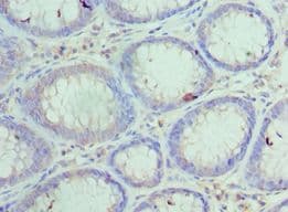 Polyclonal Rabbit anti-Human HYOU1 / ORP150 Antibody (aa1-140, IHC)