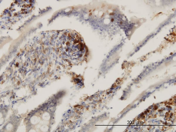 ENTPD6 Antibody (clone 2D10)