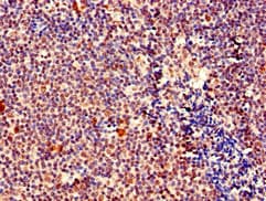 Polyclonal Rabbit anti-Human MEF2D Antibody (IHC, WB)