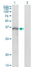 IHC-plus™ SPRY1 / Sprouty 1 Antibody (clone 3H4)