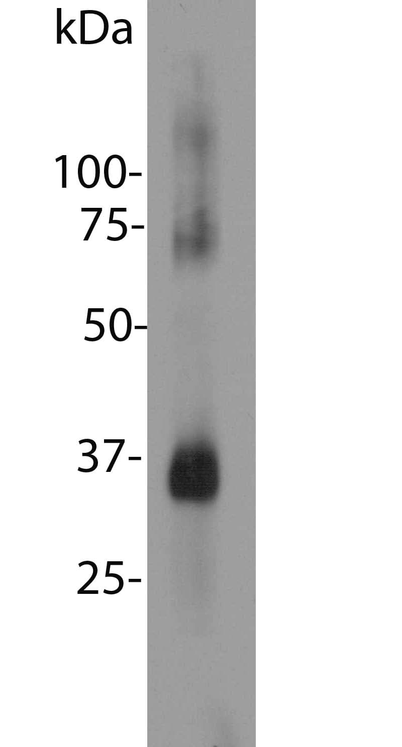 IHC-plus™ Monoclonal Mouse anti-Human Rhodopsin / RHO Antibody (clone A531, IHC, IF, WB)